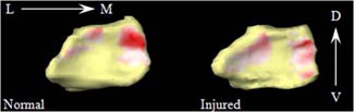 Scaphoid (left) and Lunate (right) contact intensities on the Radius fossa.