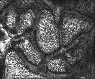 Wrist MRI