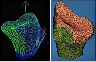 Segmented 3D Point Cloud (left); FE Mesh of the Radius and Articular Surface (right)