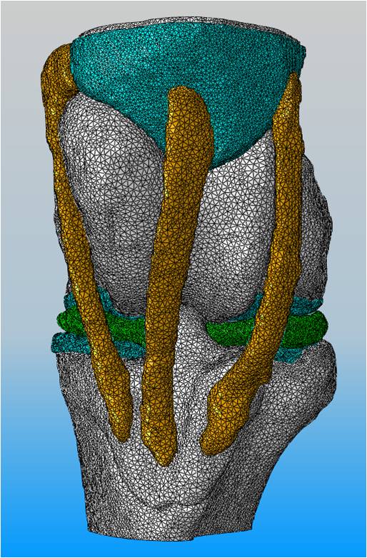 Fig 1: Finite Element Mesh (Anterior View) of an Equine Stifle Joint