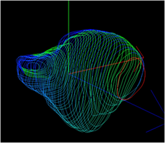 Segmented capitate