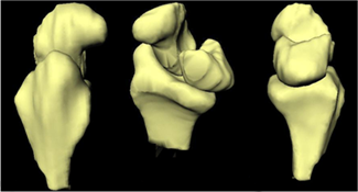 Lateral, Oblique and Medial Views of Radiocarpal Surface Models