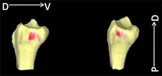 "A model showing contact area (in red) on Radius"