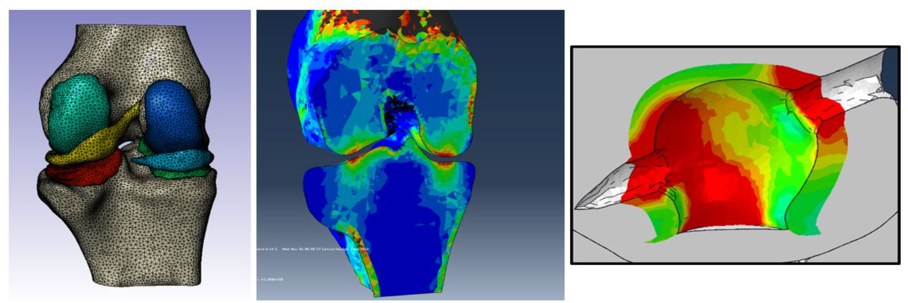 "Stifle Joint Modeling"