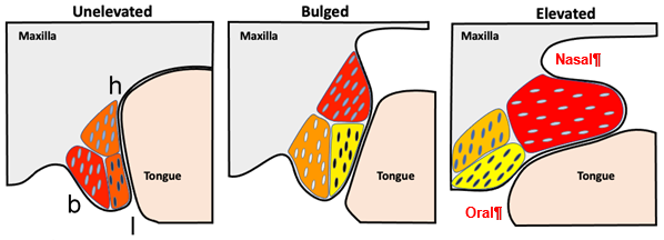 Illustration of palatal shelf elevation process, including cellular changes observed in the buccal (b), lingual (l) and hinge (h) regions of the unelevated, bulged and elevated PS.